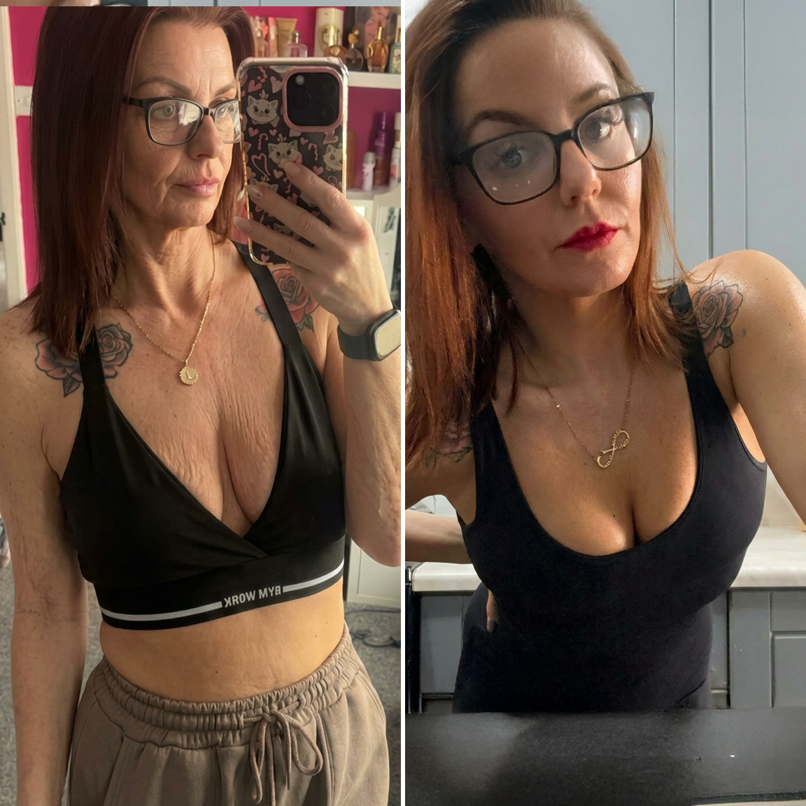 🤎HISKIN® Mikroneedlová náplast pro podporu objemu, lifting a pevnost prsou