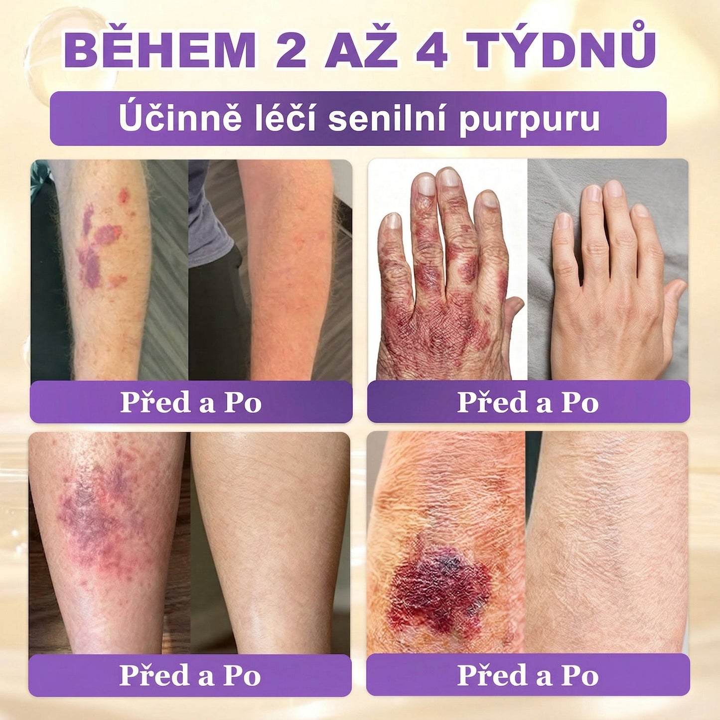 🌈Vyrobeno a odesíláno z EU ✨ 𝐆𝐎𝐋𝐃𝐊𝐈𝐒𝐒® 𝐆𝐇𝐊-𝐂𝐮 & 𝐁𝐈𝐎𝐓𝐈𝐍 𝟏𝟎-𝐕-𝟏 𝐎𝐛𝐧𝐨𝐯𝐮𝐣í𝐜í 𝐤𝐫é𝐦 𝐩𝐫𝐨 𝐩𝐥𝐞ť