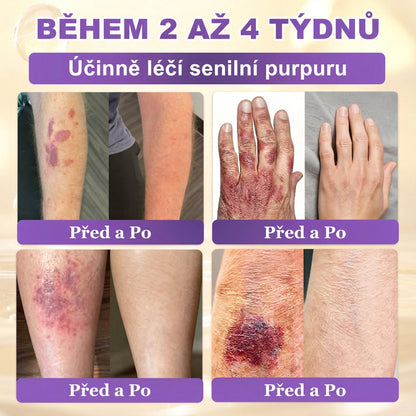 🌈Vyrobeno a odesíláno z EU ✨ 𝐆𝐎𝐋𝐃𝐊𝐈𝐒𝐒® 𝐆𝐇𝐊-𝐂𝐮 & 𝐁𝐈𝐎𝐓𝐈𝐍 𝟏𝟎-𝐕-𝟏 𝐎𝐛𝐧𝐨𝐯𝐮𝐣í𝐜í 𝐤𝐫é𝐦 𝐩𝐫𝐨 𝐩𝐥𝐞ť