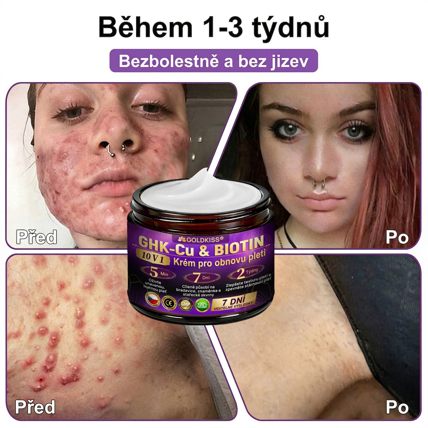 🌈Vyrobeno a odesíláno z EU ✨ 𝐆𝐎𝐋𝐃𝐊𝐈𝐒𝐒® 𝐆𝐇𝐊-𝐂𝐮 & 𝐁𝐈𝐎𝐓𝐈𝐍 𝟏𝟎-𝐕-𝟏 𝐎𝐛𝐧𝐨𝐯𝐮𝐣í𝐜í 𝐤𝐫é𝐦 𝐩𝐫𝐨 𝐩𝐥𝐞ť