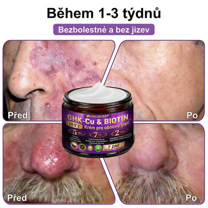 🌈Vyrobeno a odesíláno z EU ✨ 𝐆𝐎𝐋𝐃𝐊𝐈𝐒𝐒® 𝐆𝐇𝐊-𝐂𝐮 & 𝐁𝐈𝐎𝐓𝐈𝐍 𝟏𝟎-𝐕-𝟏 𝐎𝐛𝐧𝐨𝐯𝐮𝐣í𝐜í 𝐤𝐫é𝐦 𝐩𝐫𝐨 𝐩𝐥𝐞ť