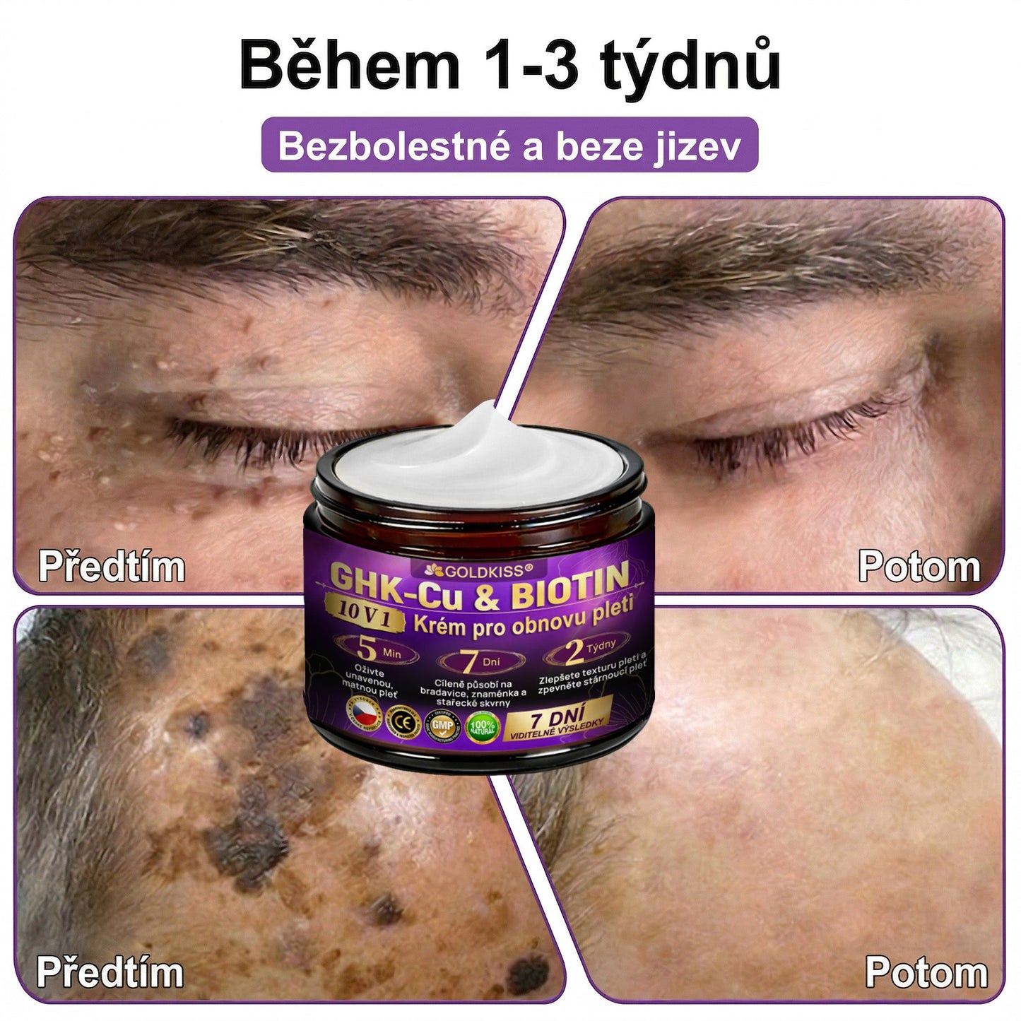 🌈Vyrobeno a odesíláno z EU ✨ 𝐆𝐎𝐋𝐃𝐊𝐈𝐒𝐒® 𝐆𝐇𝐊-𝐂𝐮 & 𝐁𝐈𝐎𝐓𝐈𝐍 𝟏𝟎-𝐕-𝟏 𝐎𝐛𝐧𝐨𝐯𝐮𝐣í𝐜í 𝐤𝐫é𝐦 𝐩𝐫𝐨 𝐩𝐥𝐞ť