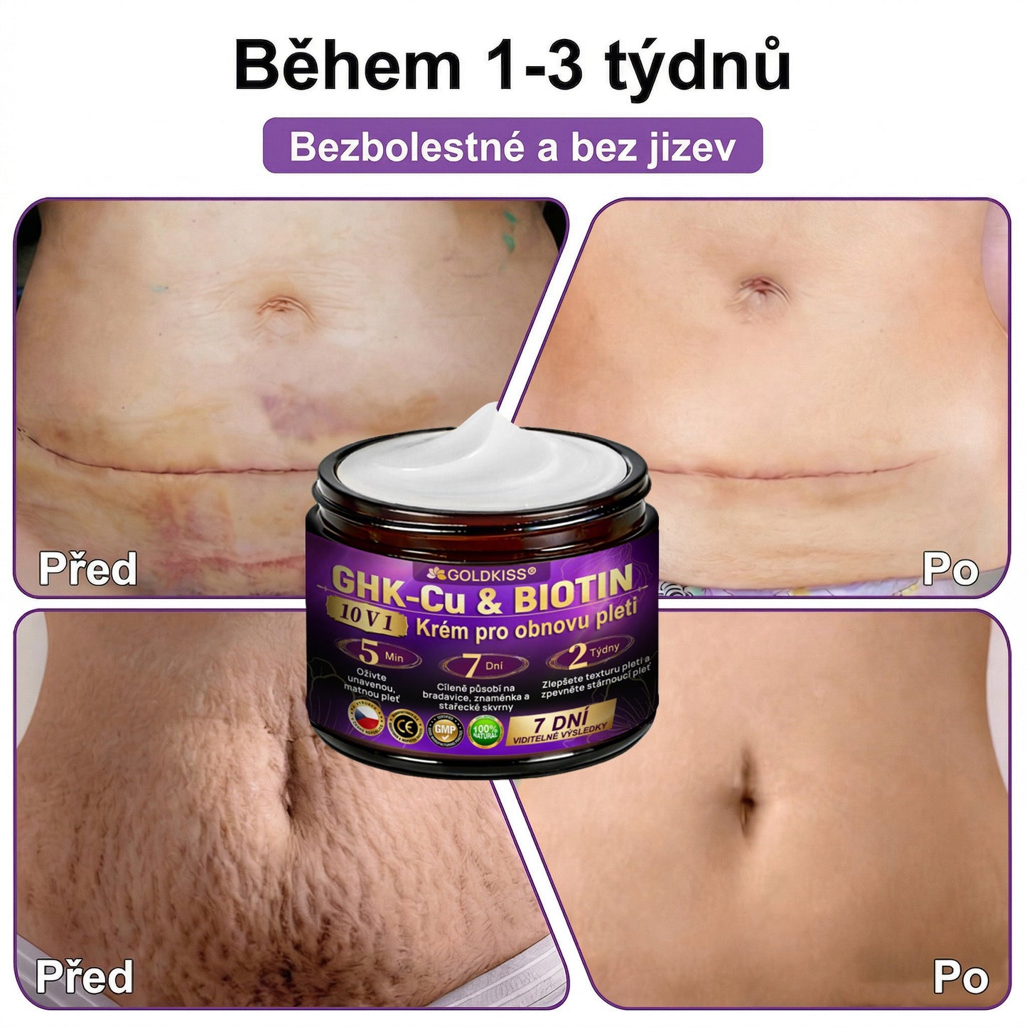 🌈Vyrobeno a odesíláno z EU ✨ 𝐆𝐎𝐋𝐃𝐊𝐈𝐒𝐒® 𝐆𝐇𝐊-𝐂𝐮 & 𝐁𝐈𝐎𝐓𝐈𝐍 𝟏𝟎-𝐕-𝟏 𝐎𝐛𝐧𝐨𝐯𝐮𝐣í𝐜í 𝐤𝐫é𝐦 𝐩𝐫𝐨 𝐩𝐥𝐞ť