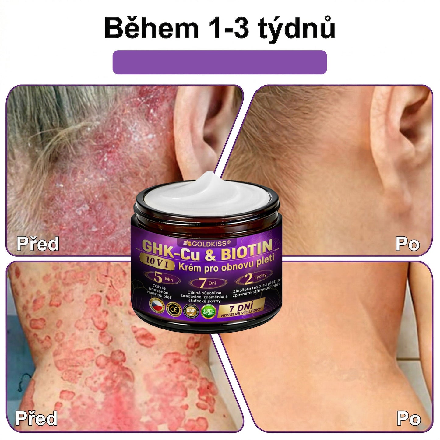 🌈Vyrobeno a odesíláno z EU ✨ 𝐆𝐎𝐋𝐃𝐊𝐈𝐒𝐒® 𝐆𝐇𝐊-𝐂𝐮 & 𝐁𝐈𝐎𝐓𝐈𝐍 𝟏𝟎-𝐕-𝟏 𝐎𝐛𝐧𝐨𝐯𝐮𝐣í𝐜í 𝐤𝐫é𝐦 𝐩𝐫𝐨 𝐩𝐥𝐞ť