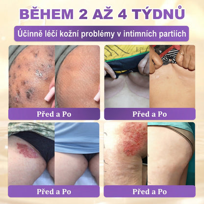 🌈Vyrobeno a odesíláno z EU ✨ 𝐆𝐎𝐋𝐃𝐊𝐈𝐒𝐒® 𝐆𝐇𝐊-𝐂𝐮 & 𝐁𝐈𝐎𝐓𝐈𝐍 𝟏𝟎-𝐕-𝟏 𝐎𝐛𝐧𝐨𝐯𝐮𝐣í𝐜í 𝐤𝐫é𝐦 𝐩𝐫𝐨 𝐩𝐥𝐞ť