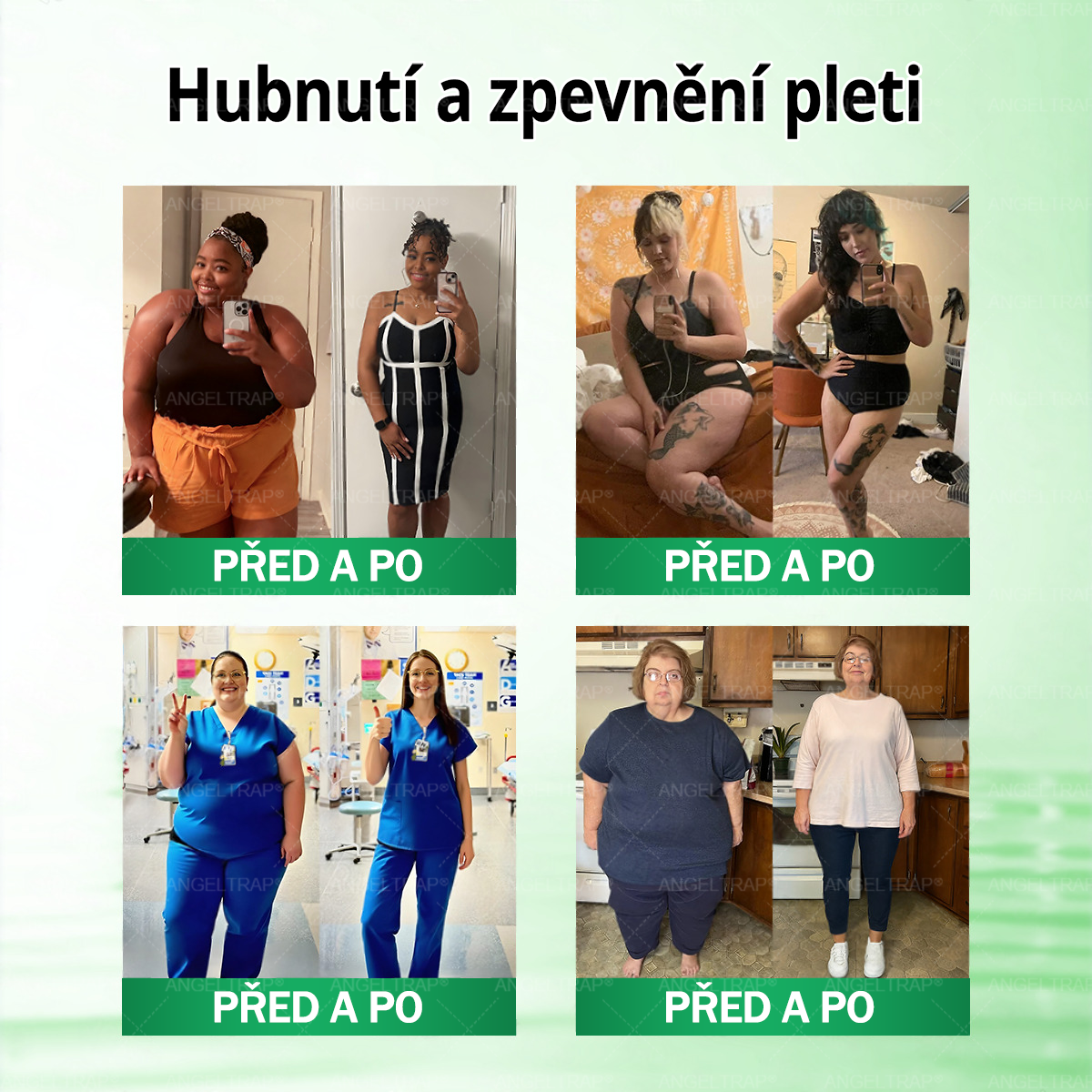 🍀✨Oficiální prodejna  |  🧑‍⚕️ANGELTRAP® 𝐌𝐨𝐫𝐢𝐧𝐠𝐚 × 𝐁𝐞𝐫𝐛𝐞𝐫𝐲𝐧𝐚 × 𝐀𝐌𝐏𝐊 𝟏𝟎 v 1 – Zeštíhlující nano mikrojihlový náplast 🇨🇿 Jen 1× denně ✅ Viditelné změny za 7 dní – na obezitu, kardiovaskulární zdraví, diabetes a kloubní problémy
