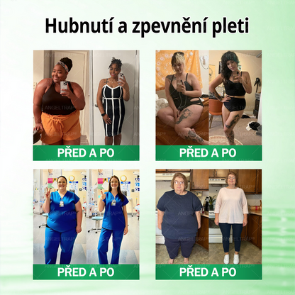 🍀✨Oficiální prodejna  |  🧑‍⚕️ANGELTRAP® 𝐌𝐨𝐫𝐢𝐧𝐠𝐚 × 𝐁𝐞𝐫𝐛𝐞𝐫𝐲𝐧𝐚 × 𝐀𝐌𝐏𝐊 𝟏𝟎 v 1 – Zeštíhlující nano mikrojihlový náplast 🇨🇿 Jen 1× denně ✅ Viditelné změny za 7 dní – na obezitu, kardiovaskulární zdraví, diabetes a kloubní problémy