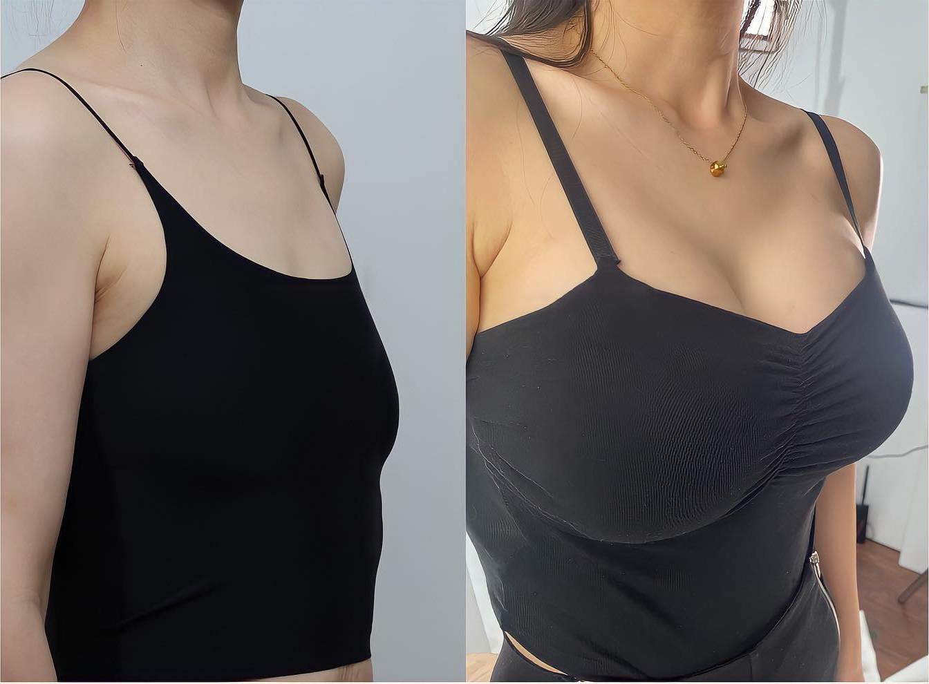 🤎HISKIN® Mikroneedlová náplast pro podporu objemu, lifting a pevnost prsou