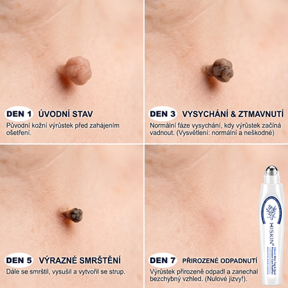 HISKIN® 🎁🎁🎁 Zbývá už jen 10 balení! Nyní vám poskytujeme dalších 50% slevy navíc! Nenechte si ujít tuto speciální nabídku, protože stejná sleva se znovu objeví až po delší době.