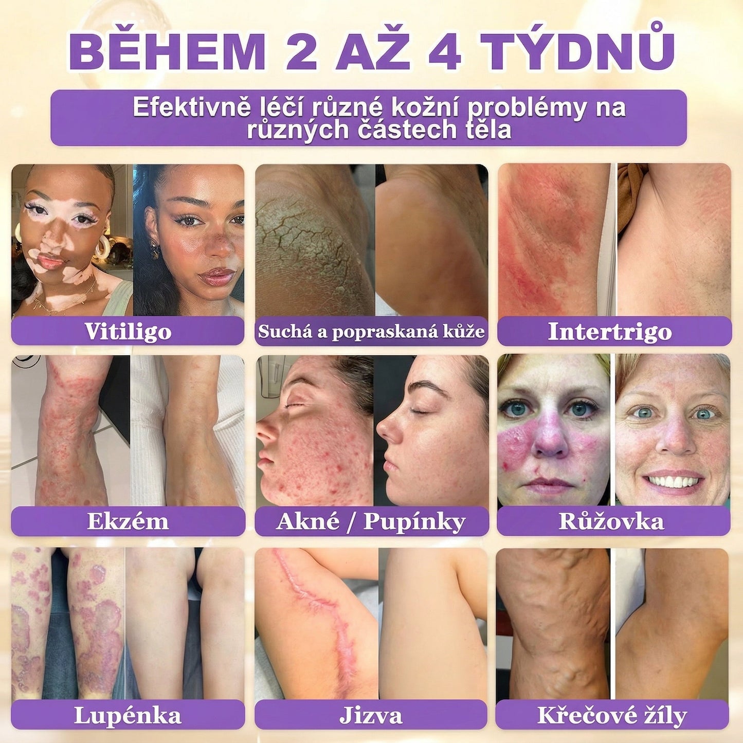 🌈Vyrobeno a odesíláno z EU ✨ 𝐆𝐎𝐋𝐃𝐊𝐈𝐒𝐒® 𝐆𝐇𝐊-𝐂𝐮 & 𝐁𝐈𝐎𝐓𝐈𝐍 𝟏𝟎-𝐕-𝟏 𝐎𝐛𝐧𝐨𝐯𝐮𝐣í𝐜í 𝐤𝐫é𝐦 𝐩𝐫𝐨 𝐩𝐥𝐞ť