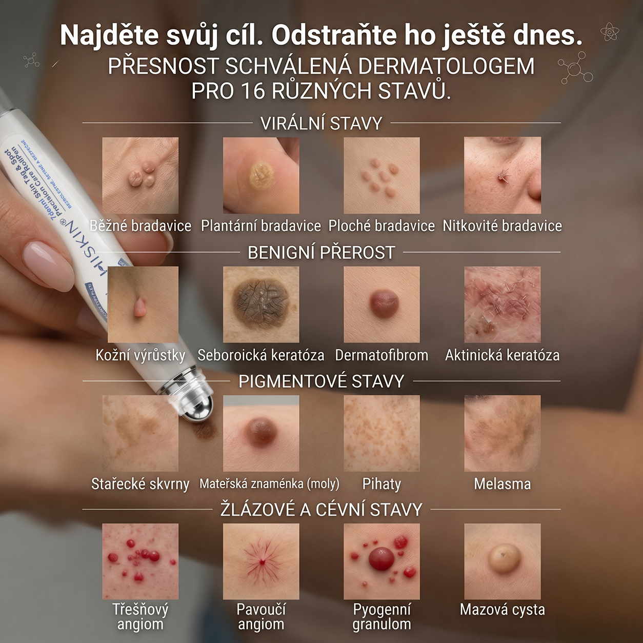 HISKIN® 🎁🎁🎁 Zbývá už jen 10 balení! Nyní vám poskytujeme dalších 50% slevy navíc! Nenechte si ujít tuto speciální nabídku, protože stejná sleva se znovu objeví až po delší době.