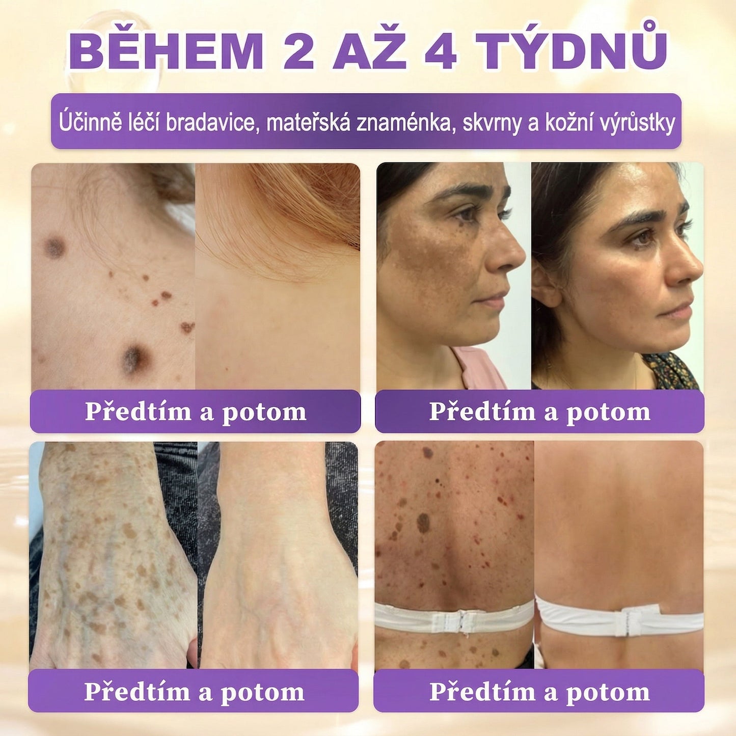🌈Vyrobeno a odesíláno z EU ✨ 𝐆𝐎𝐋𝐃𝐊𝐈𝐒𝐒® 𝐆𝐇𝐊-𝐂𝐮 & 𝐁𝐈𝐎𝐓𝐈𝐍 𝟏𝟎-𝐕-𝟏 𝐎𝐛𝐧𝐨𝐯𝐮𝐣í𝐜í 𝐤𝐫é𝐦 𝐩𝐫𝐨 𝐩𝐥𝐞ť