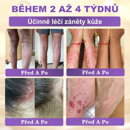 🌈Vyrobeno a odesíláno z EU ✨ 𝐆𝐎𝐋𝐃𝐊𝐈𝐒𝐒® 𝐆𝐇𝐊-𝐂𝐮 & 𝐁𝐈𝐎𝐓𝐈𝐍 𝟏𝟎-𝐕-𝟏 𝐎𝐛𝐧𝐨𝐯𝐮𝐣í𝐜í 𝐤𝐫é𝐦 𝐩𝐫𝐨 𝐩𝐥𝐞ť