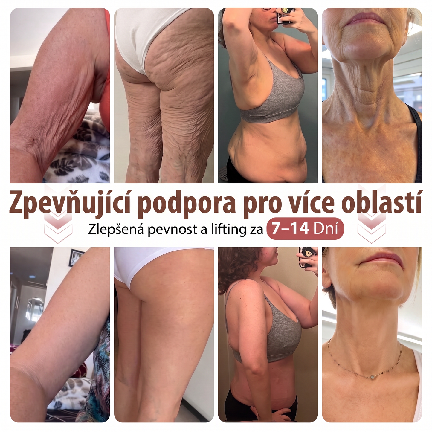 🤎HISKIN® Mikroneedlová náplast pro podporu objemu, lifting a pevnost prsou