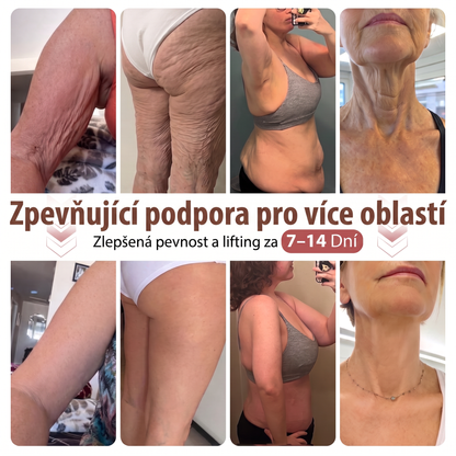 🤎HISKIN® Mikroneedlová náplast pro podporu objemu, lifting a pevnost prsou