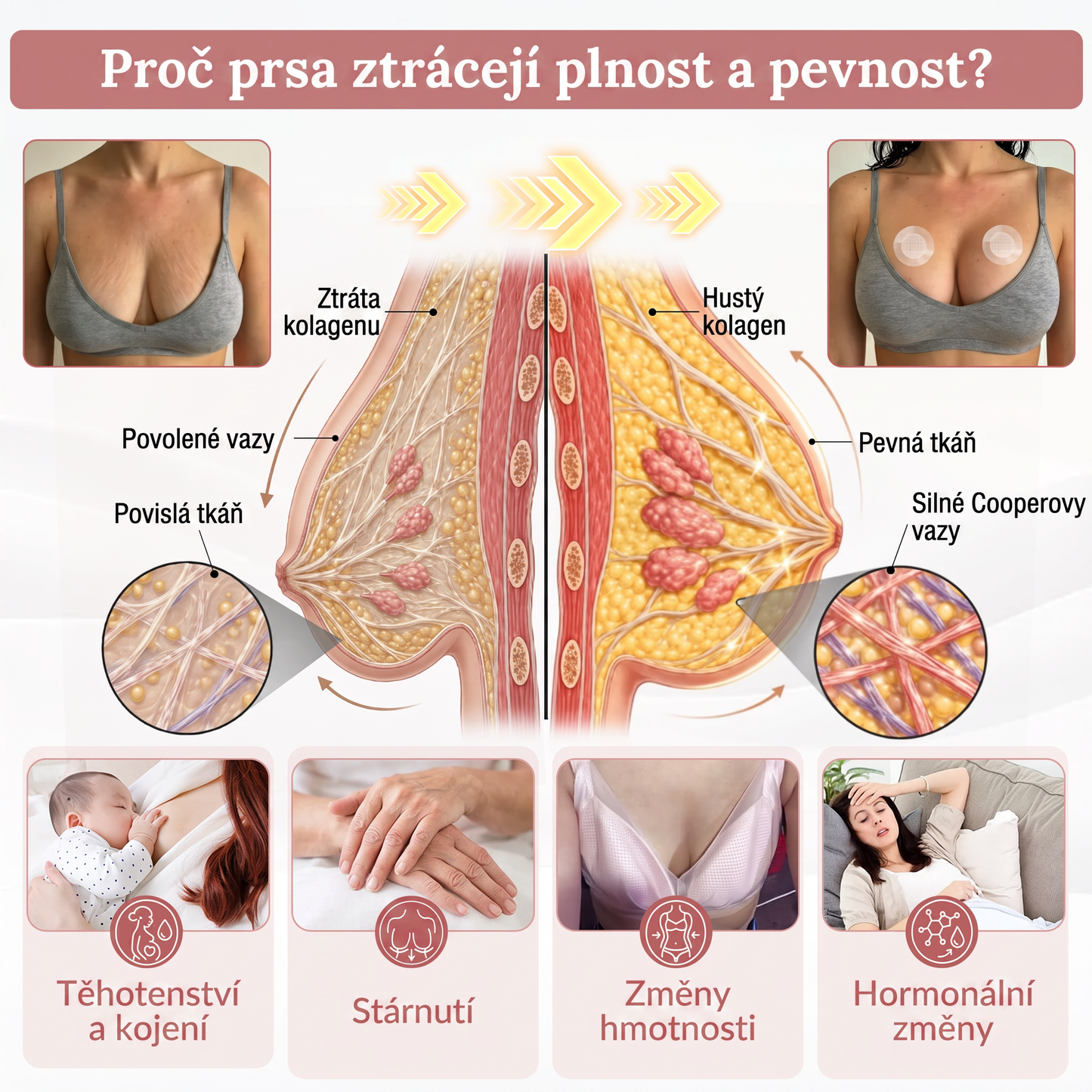 🤎HISKIN® Mikroneedlová náplast pro podporu objemu, lifting a pevnost prsou