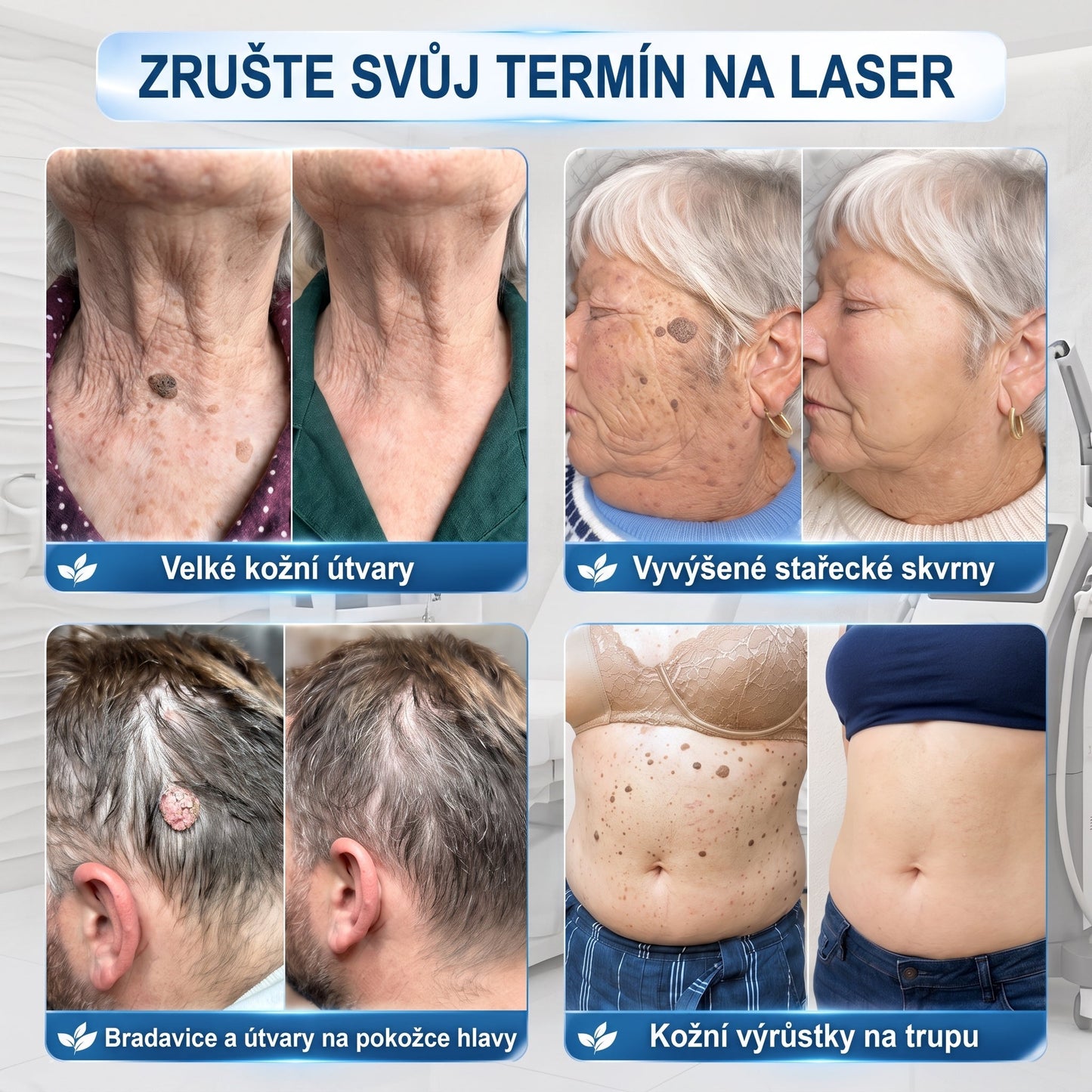 HISKIN® 🎁🎁🎁 Zbývá už jen 10 balení! Nyní vám poskytujeme dalších 50% slevy navíc! Nenechte si ujít tuto speciální nabídku, protože stejná sleva se znovu objeví až po delší době.