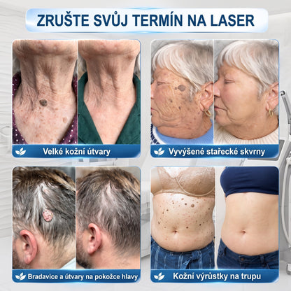 HISKIN® 🎁🎁🎁 Zbývá už jen 10 balení! Nyní vám poskytujeme dalších 50% slevy navíc! Nenechte si ujít tuto speciální nabídku, protože stejná sleva se znovu objeví až po delší době.