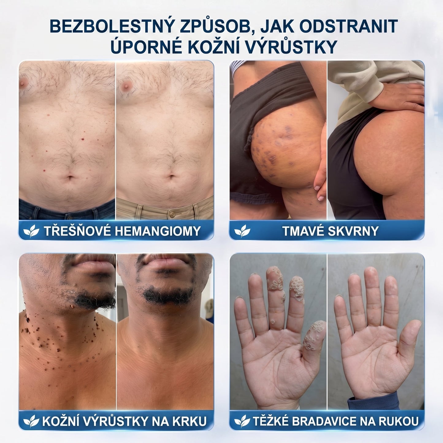 HISKIN® 🎁🎁🎁 Zbývá už jen 10 balení! Nyní vám poskytujeme dalších 50% slevy navíc! Nenechte si ujít tuto speciální nabídku, protože stejná sleva se znovu objeví až po delší době.