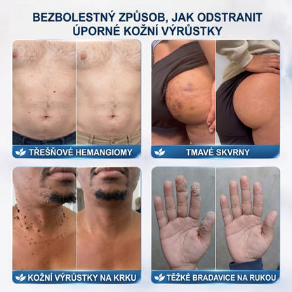 HISKIN® 🎁🎁🎁 Zbývá už jen 10 balení! Nyní vám poskytujeme dalších 50% slevy navíc! Nenechte si ujít tuto speciální nabídku, protože stejná sleva se znovu objeví až po delší době.